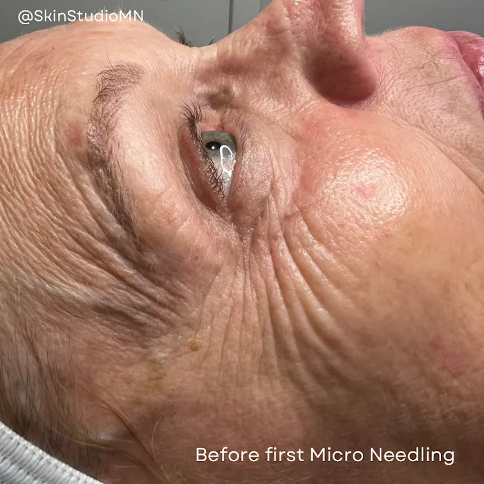 SkinStudioMN Picture 7