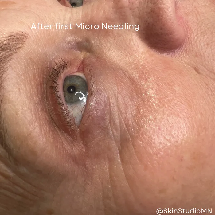 SkinStudioMN Picture 9