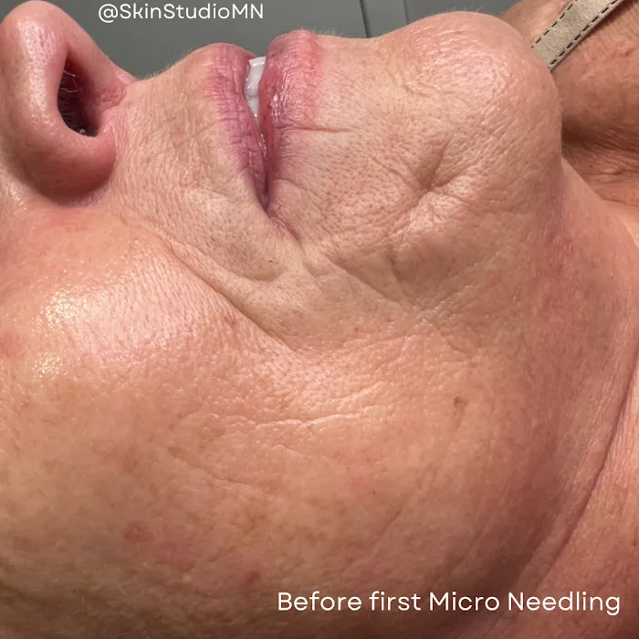 SkinStudioMN Picture 10