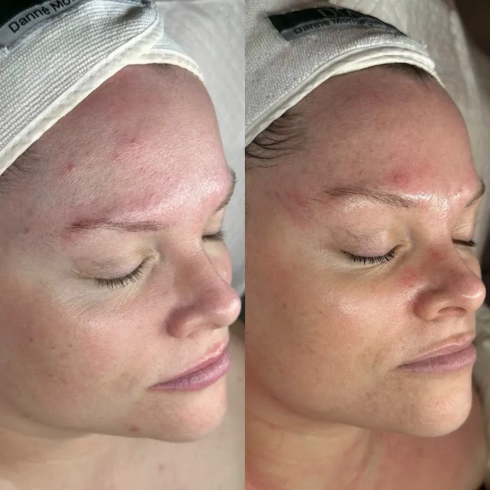 The Skin Standard Picture 7