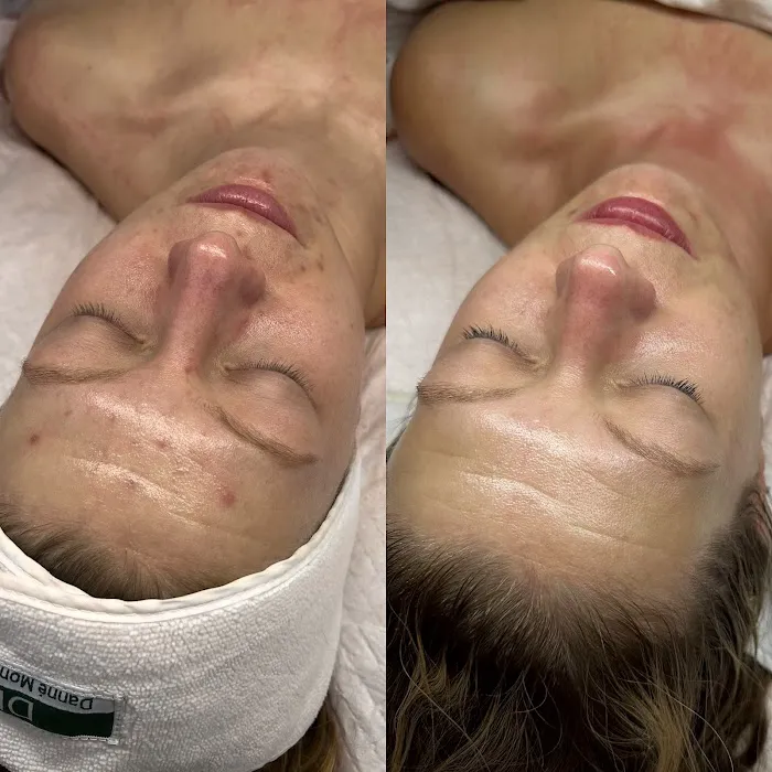 The Skin Standard Picture 9