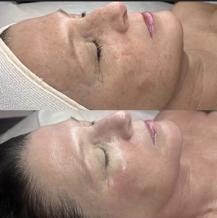 The Skin Standard Picture 6