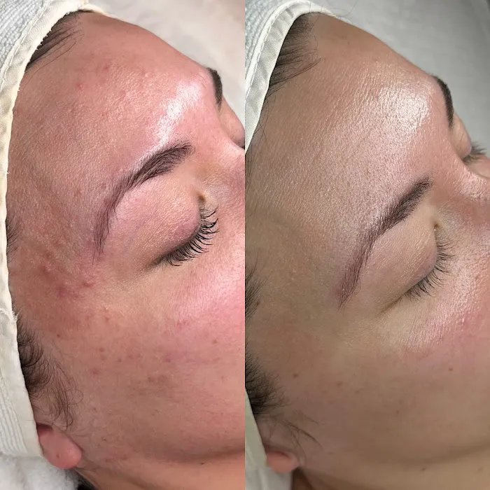 The Skin Standard Picture 8