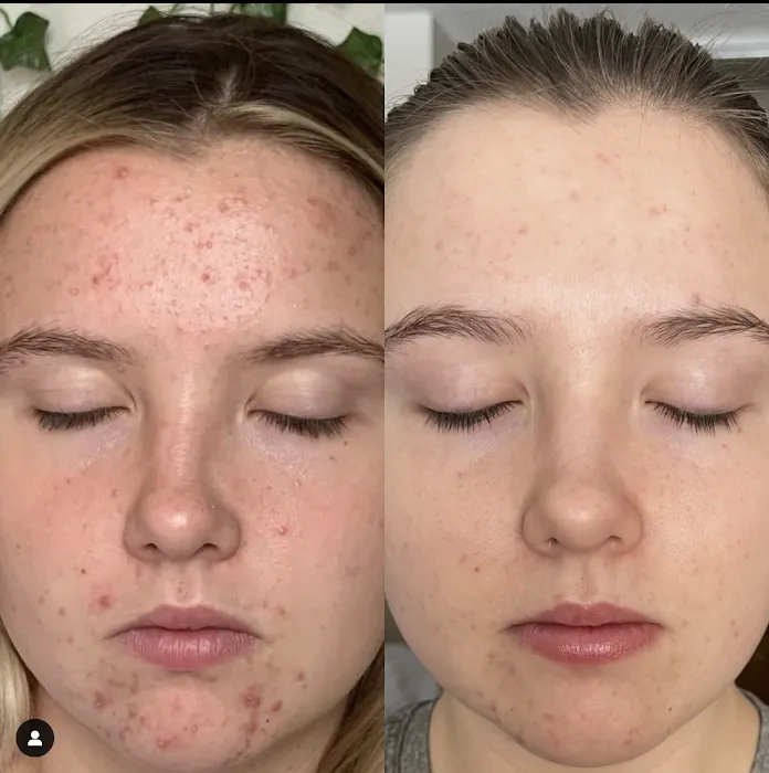 Faces Advanced Skin Therapy Picture 4