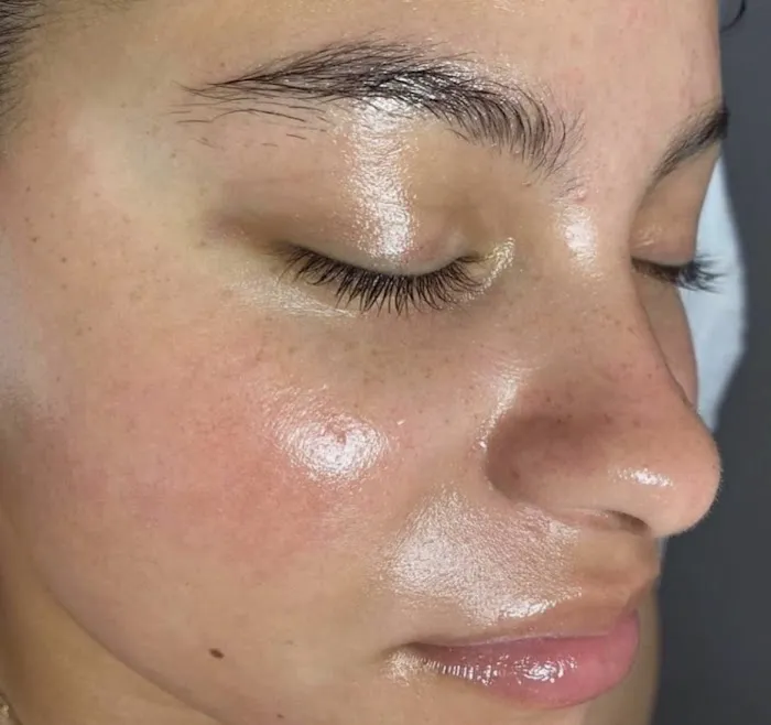 Superior Skin Aesthetics Picture 1