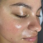 Superior Skin Aesthetics