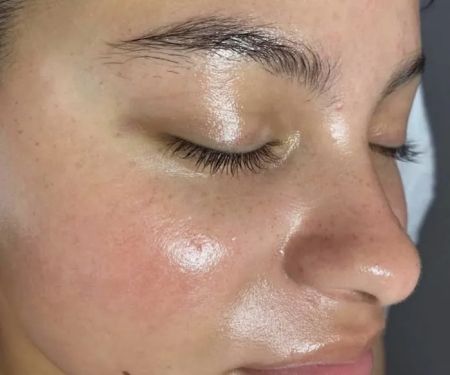 Superior Skin Aesthetics
