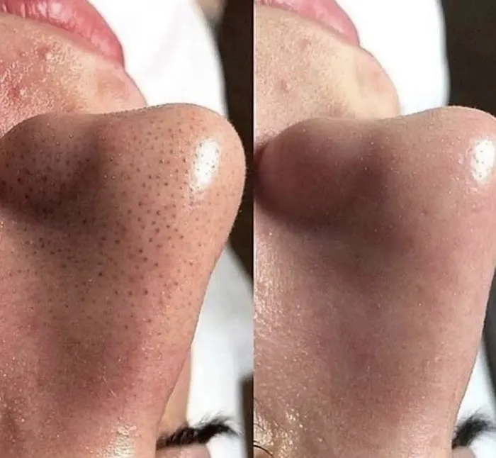 Superior Skin Aesthetics Picture 2