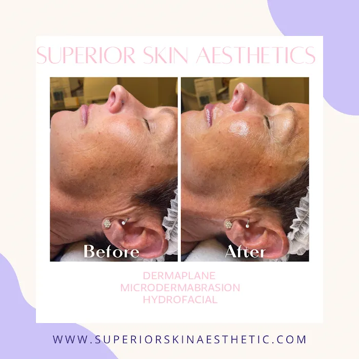Superior Skin Aesthetics Picture 3