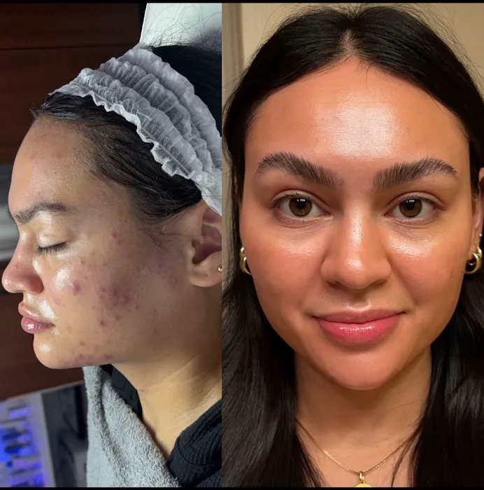 Superior Skin Aesthetics Picture 5