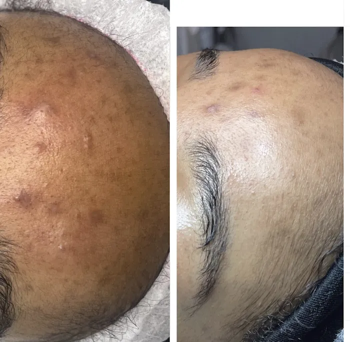 Superior Skin Aesthetics Picture 6