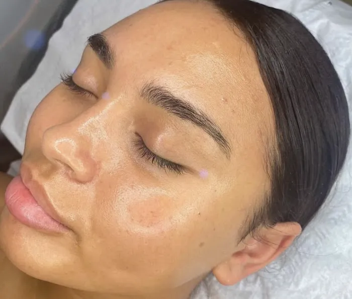 Superior Skin Aesthetics Picture 9