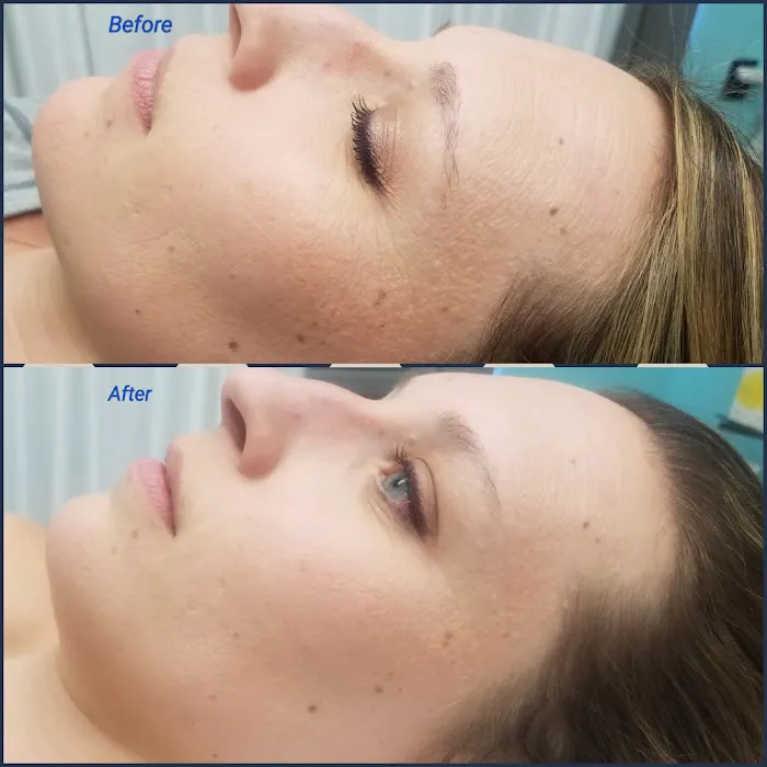 KLOE- Krista Leigh Olson Esthetics Picture 4