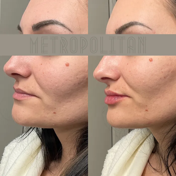 Metropolitan Skin Clinic Picture 8