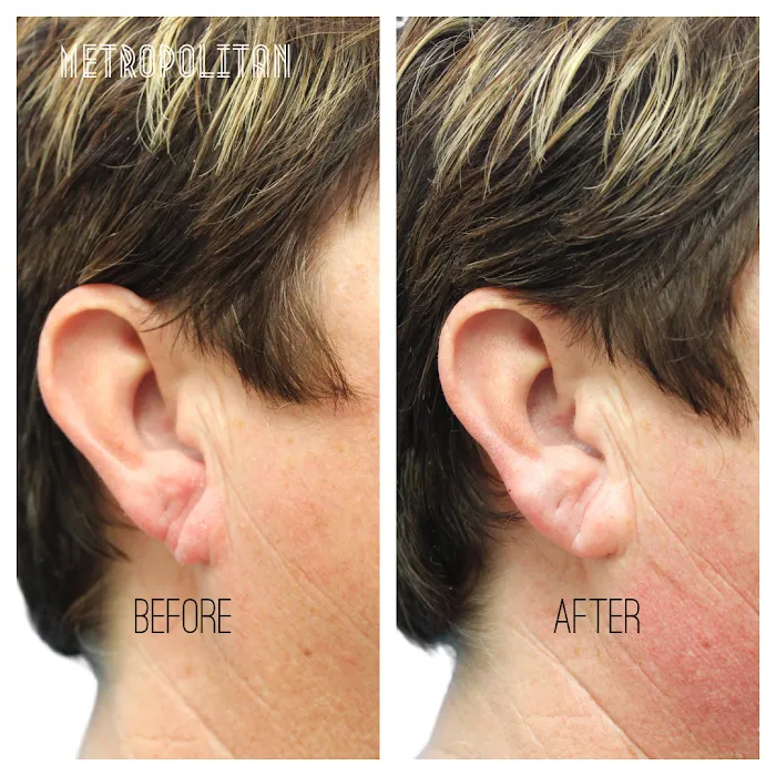 Metropolitan Skin Clinic Picture 7