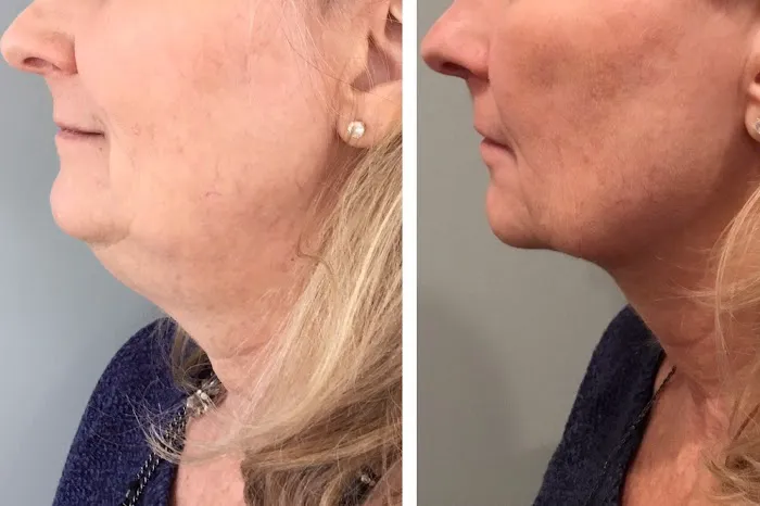 Minneapolis Anti-Aging & Skin Clinic Picture 5