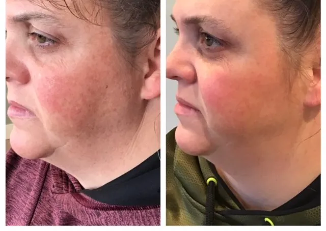 Minneapolis Anti-Aging & Skin Clinic Picture 7