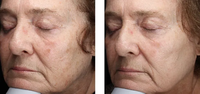 Minneapolis Anti-Aging & Skin Clinic Picture 9