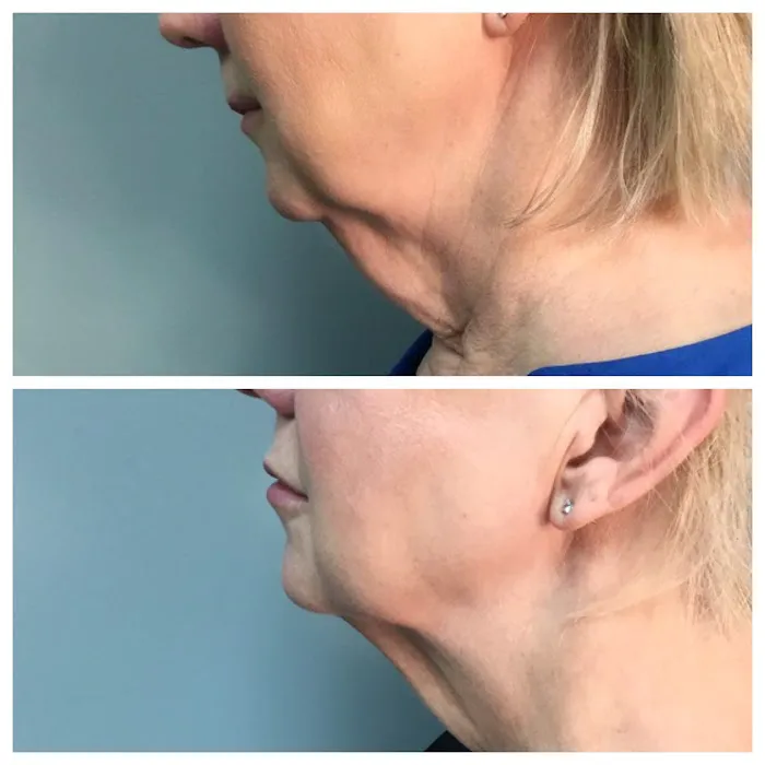 Minneapolis Anti-Aging & Skin Clinic Picture 10