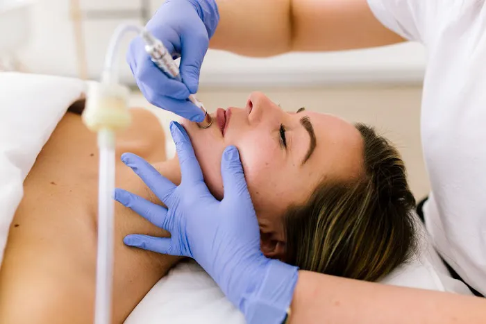 Skin MPLS Picture 10