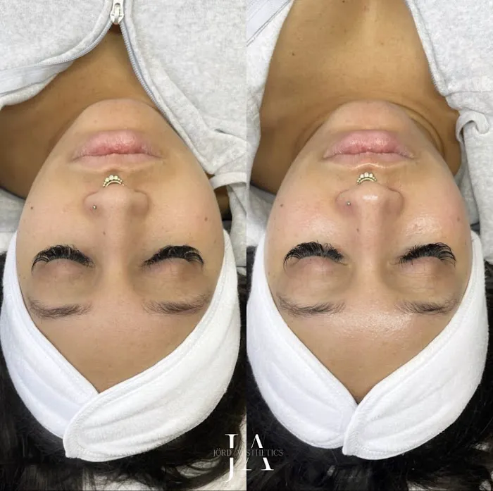 Jord Aesthetics Picture 5