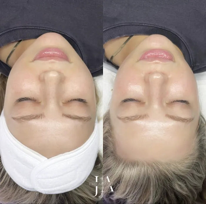 Jord Aesthetics Picture 6