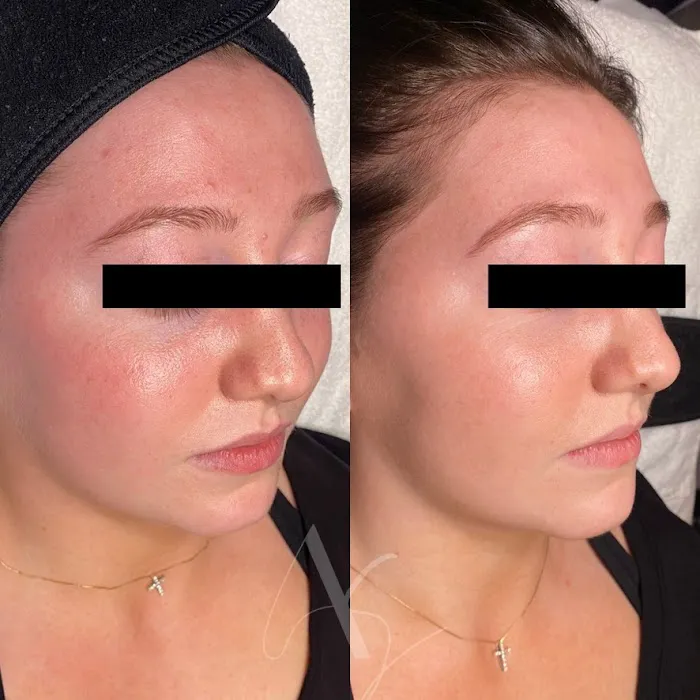 Atheria Skin Picture 3