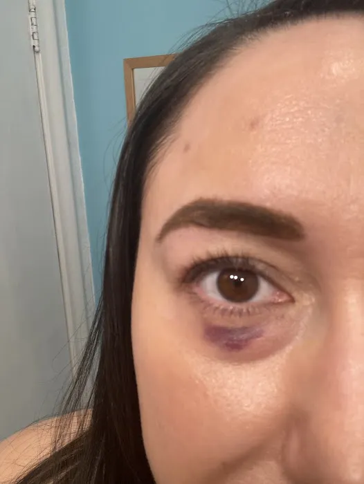 Skin Rejuvenation Clinic PA Picture 5