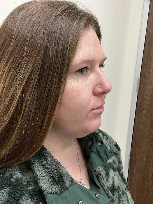 Skin Rejuvenation Clinic PA Picture 9