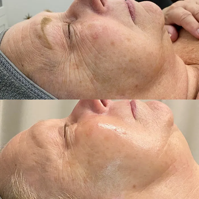 Kami Dawn Radiance Room Picture 2