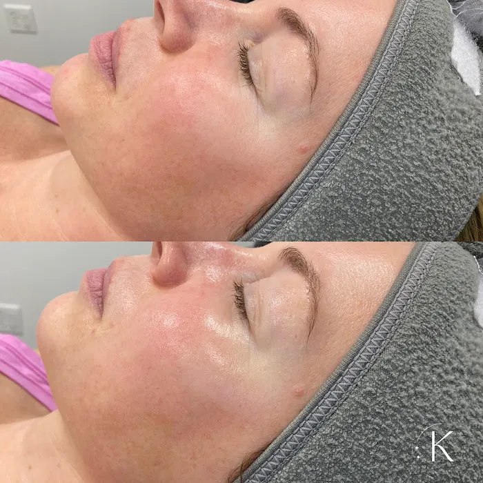 Kami Dawn Radiance Room Picture 4