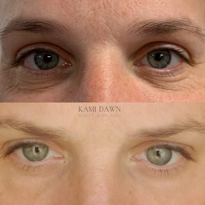 Kami Dawn Radiance Room Picture 9