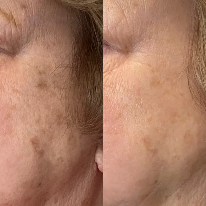 Kami Dawn Radiance Room Picture 10