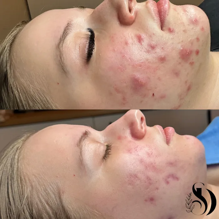 Skin By Devyn Picture 6