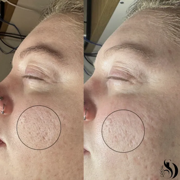 Skin By Devyn Picture 4