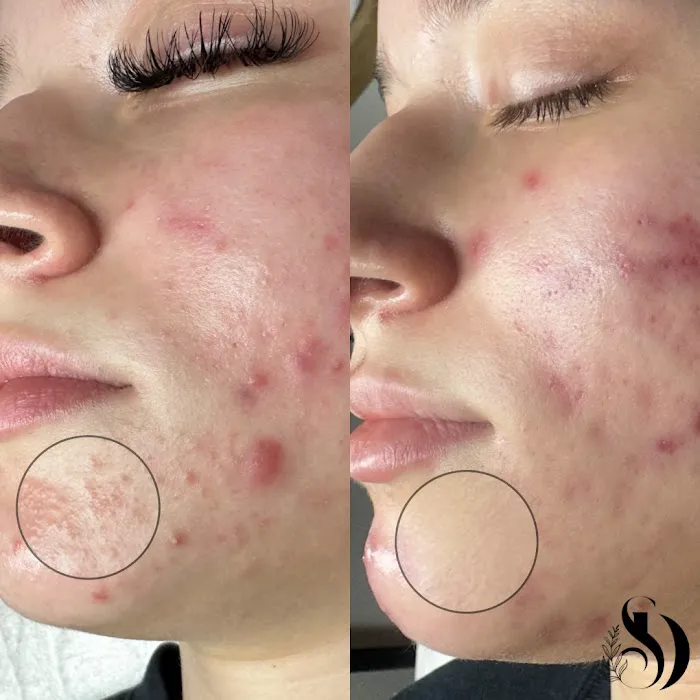 Skin By Devyn Picture 7