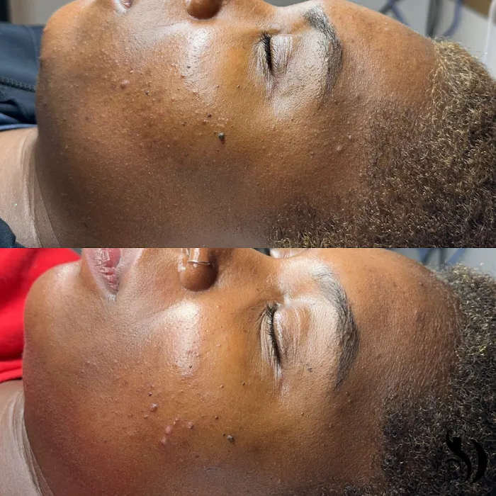 Skin By Devyn Picture 9