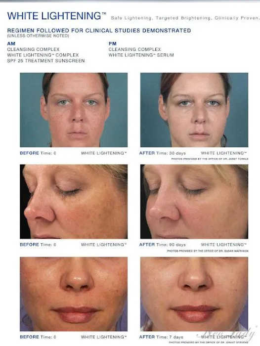 Cindy Ravn, Skin & Health Picture 4