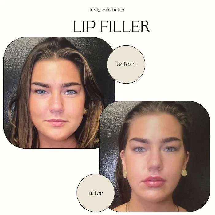 Juvly Aesthetics Picture 8