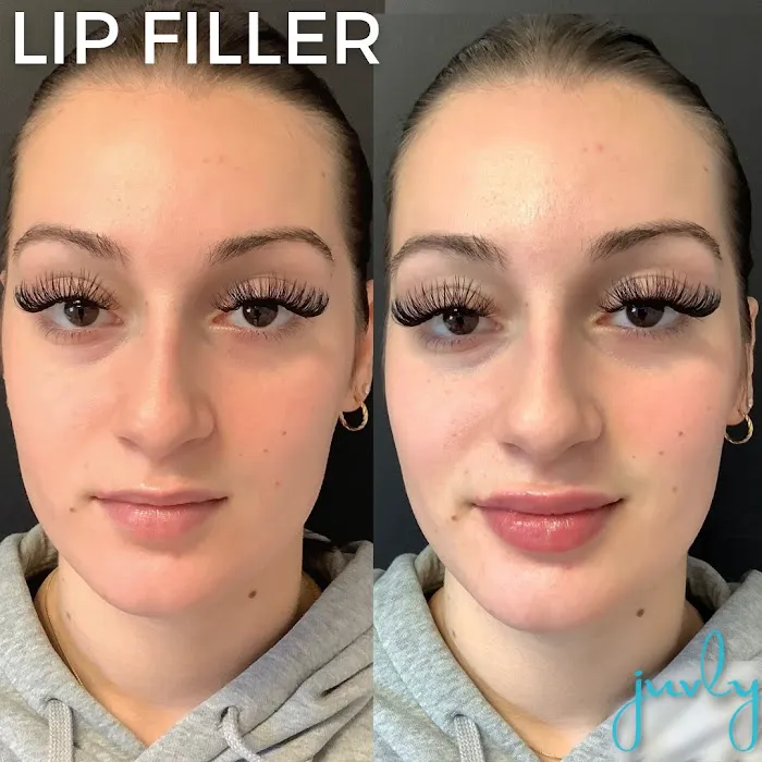 Juvly Aesthetics Picture 6