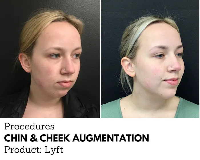 Juvly Aesthetics Picture 5