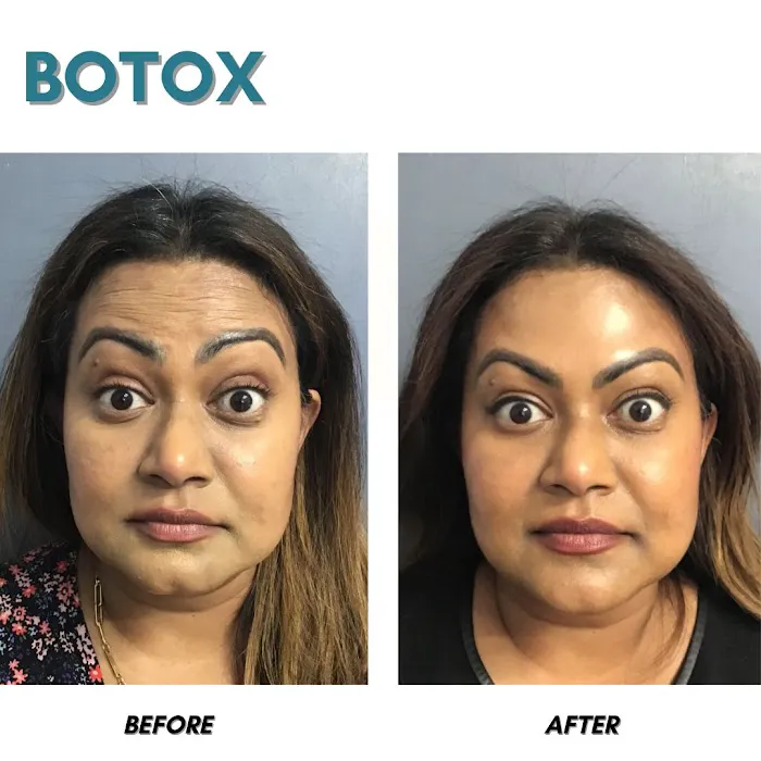 Juvly Aesthetics Picture 9