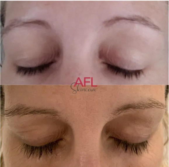 AFL Skincare Picture 8