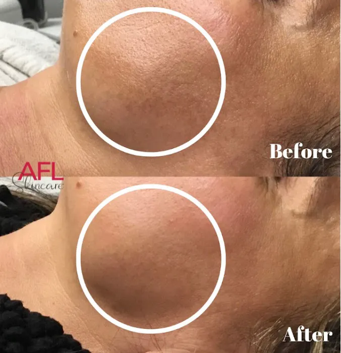 AFL Skincare Picture 9