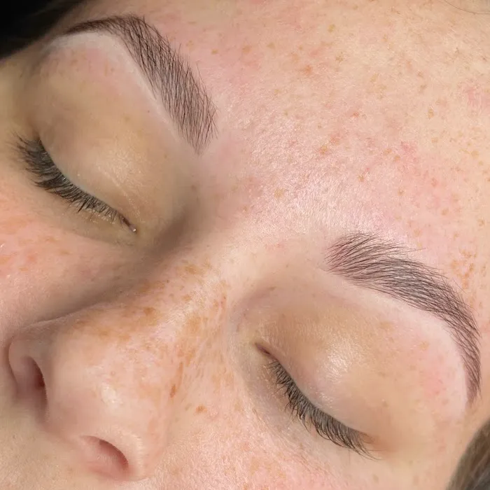 The Skn Rm Picture 4