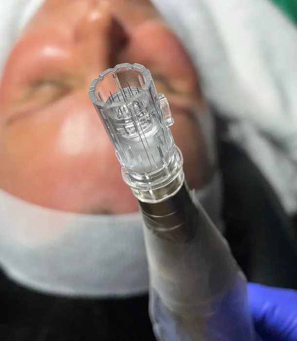 The Skn Rm Picture 9