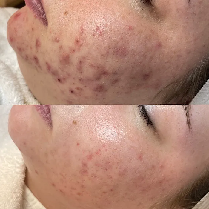 The Skn Rm Picture 8