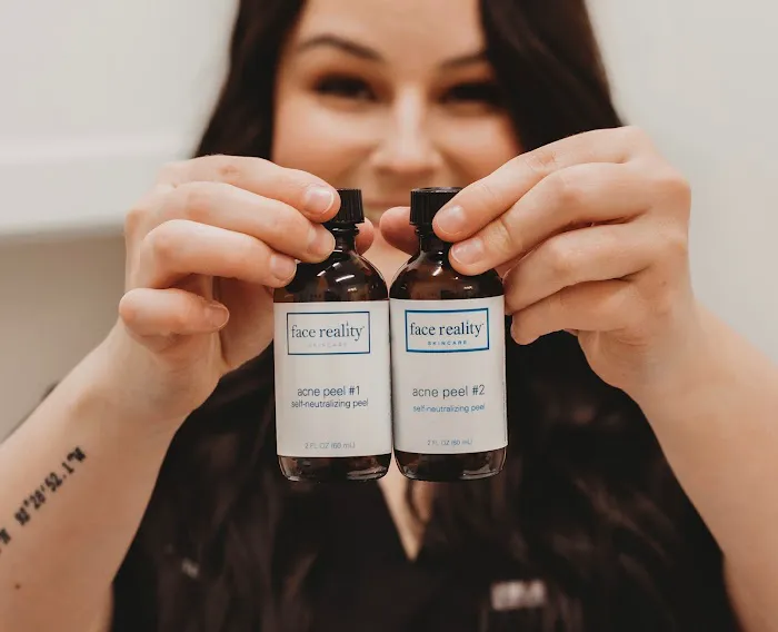 The Skn Rm Picture 7