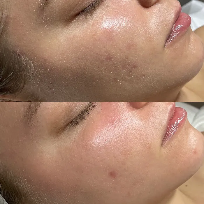 The Skn Rm Picture 10