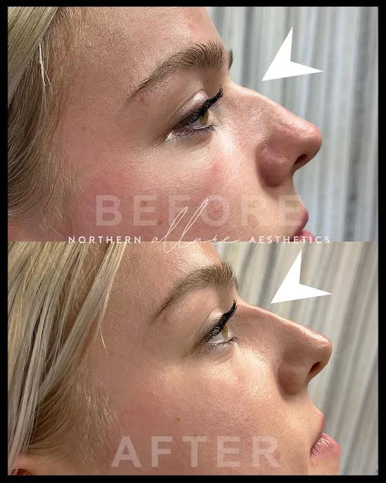 Northern Allure Aesthetics Picture 6